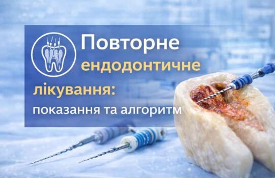 Повторне ендодонтичне лікування – дезобтурація кореневого каналу та робота ендодонтичним інструментом compressed